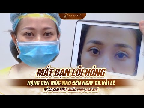 #1 Mí mắt lỗi hỏng tái hỏng nhiều lần đến ngay Dr.Hải Lê để có giải pháp khắc phục Mới Nhất