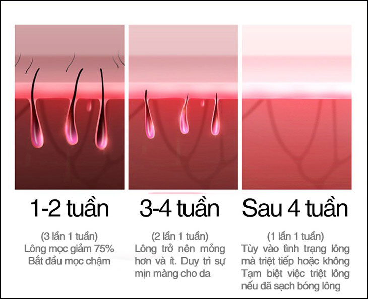 Tần suất sử dụng các thiết bị tẩy lông