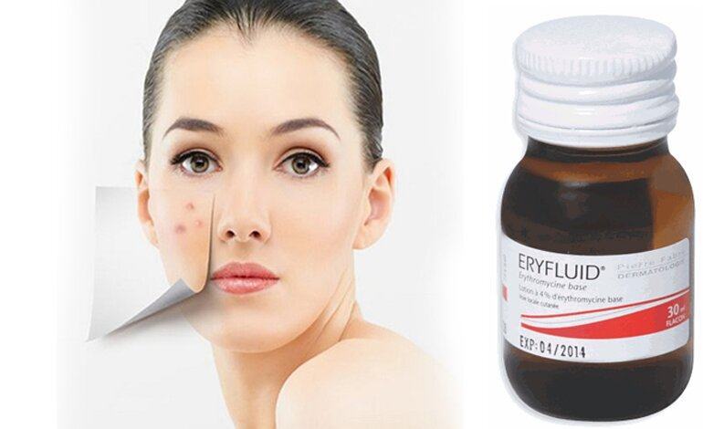 Thuốc Eryfluid trị mụn có tốt không ? Giá bao nhiêu ?