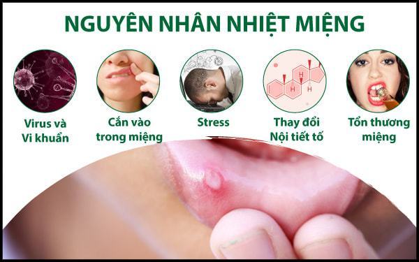 Nguyên nhân của đau miệng