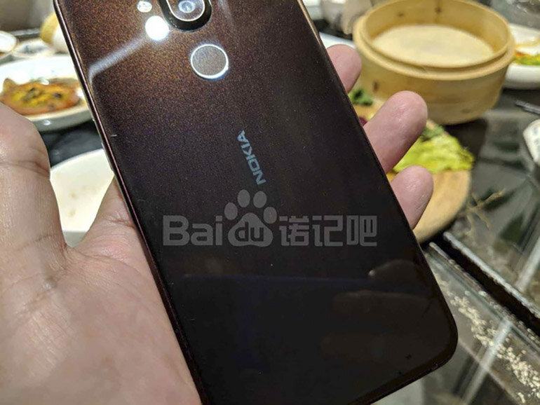 Điện thoại Nokia 7.1 và 7.1 Plus lộ ảnh thực tế - Thời gian phát hành có thể là ngày 4/10