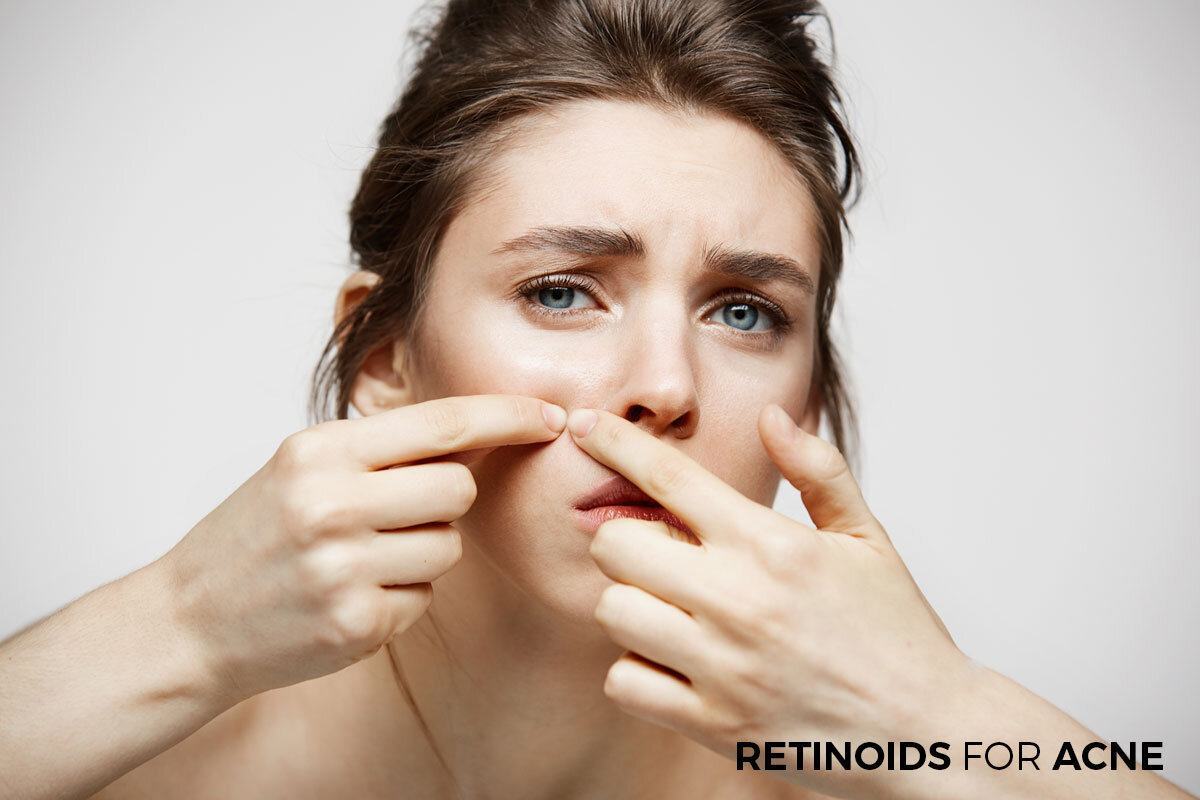 Những điều cần nắm rõ “như lòng bàn tay” khi sử dụng Retinoids