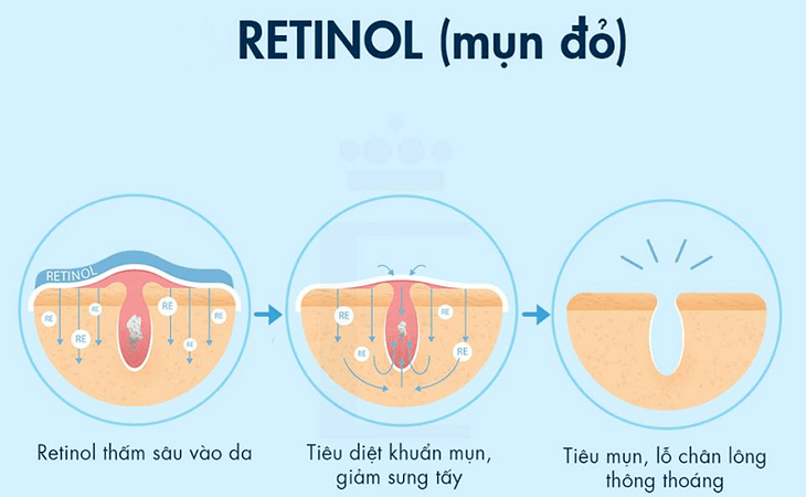 Retinol – Thành phần chống lão hóa, trị mụn và trẻ hóa da